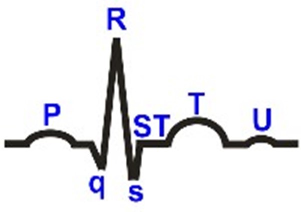 ekg01112022 2