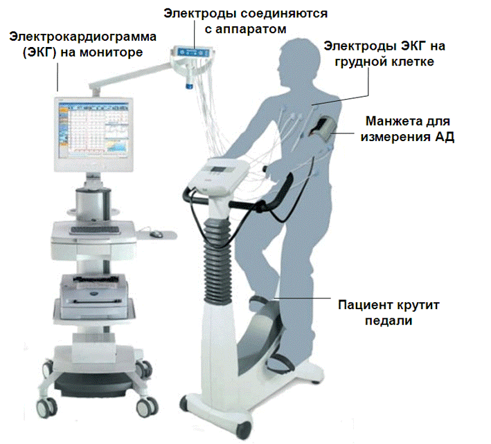 Экг с физ нагрузкой. Нагрузочная проба ВЭМ. Нагрузочные пробы (тредмил-тест, ВЭМ). ВЭМ тредмил что это. Проба с физической нагрузкой (велоэргометрия, тредмил).